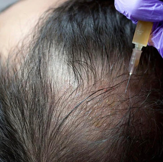 PRP Treatment: A Natural Way to Regrow, Repair and Rejuvenate