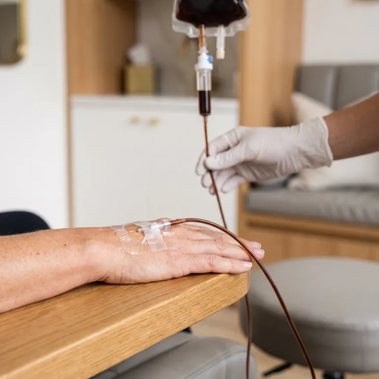 Iron infusion running into a cannula in the hand