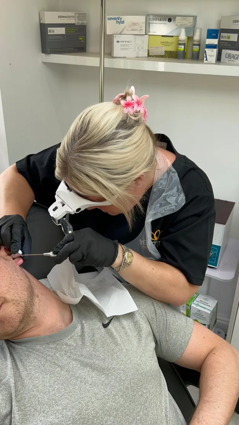 Microsuction ear wax removal