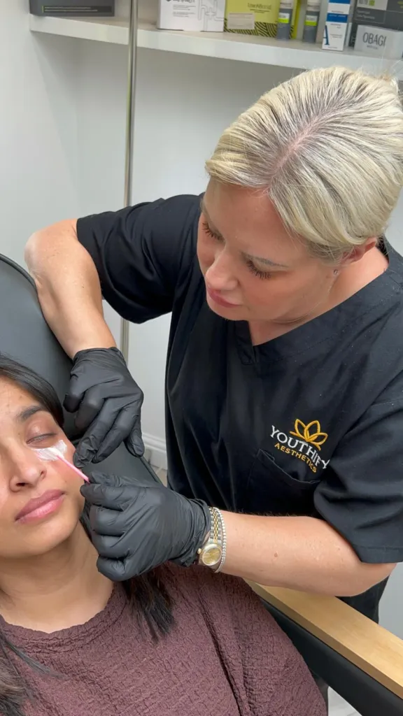 Tear trough treatment